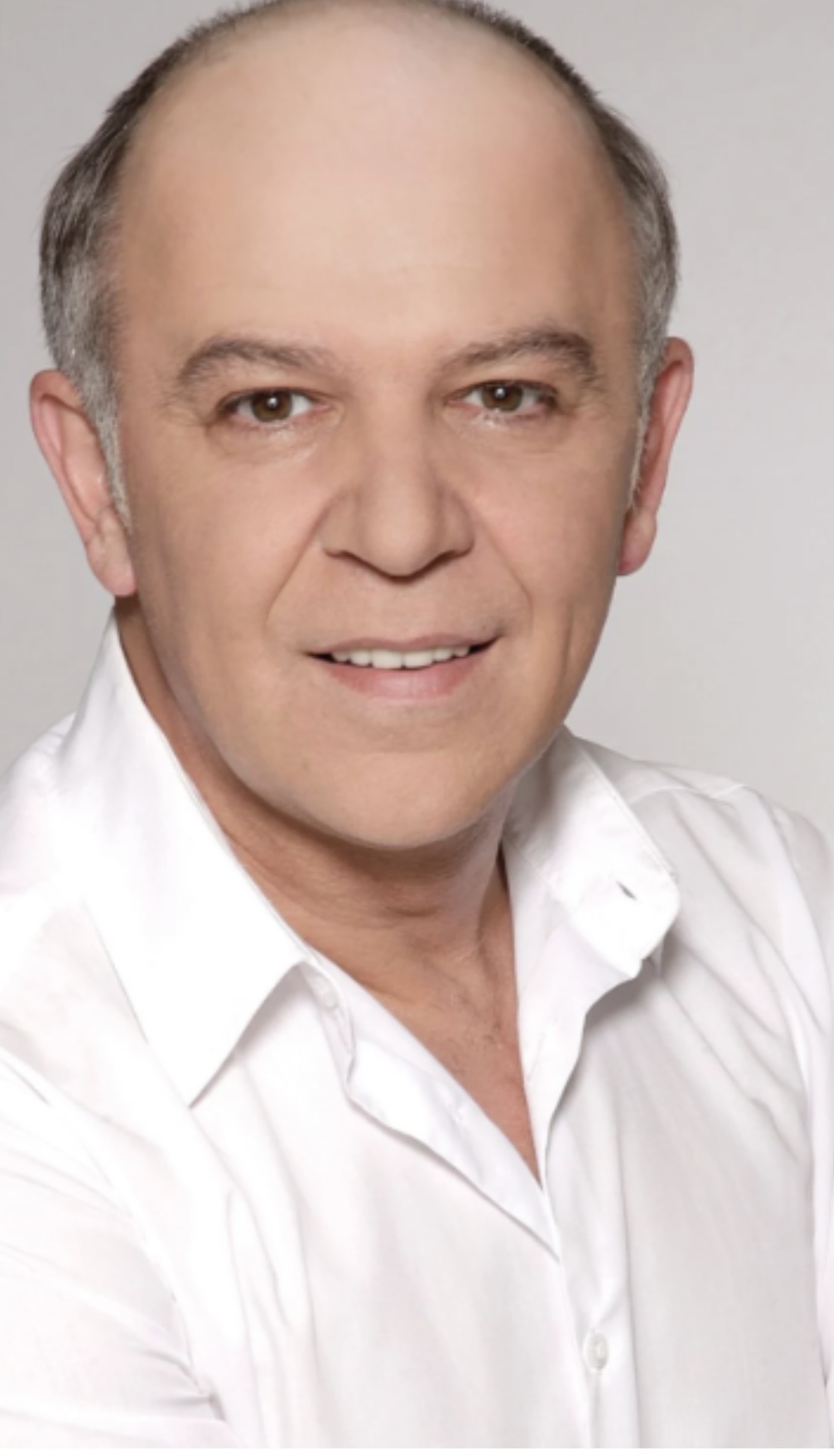Faik Ünüvar before, with thinning hair and a receding hairline