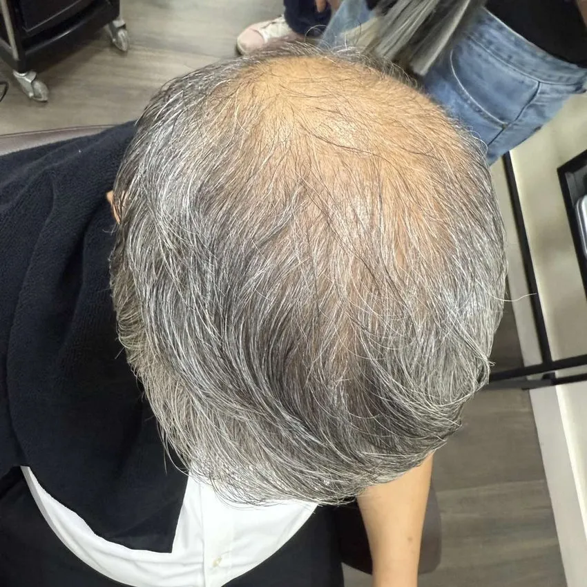 Real HEADS client in Makati — thinning grey crown before his hair system