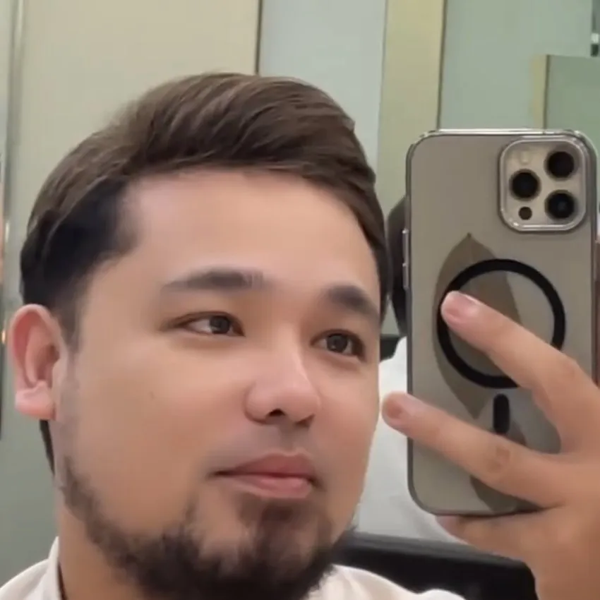 Real HEADS client in Manila with a natural men's hair system