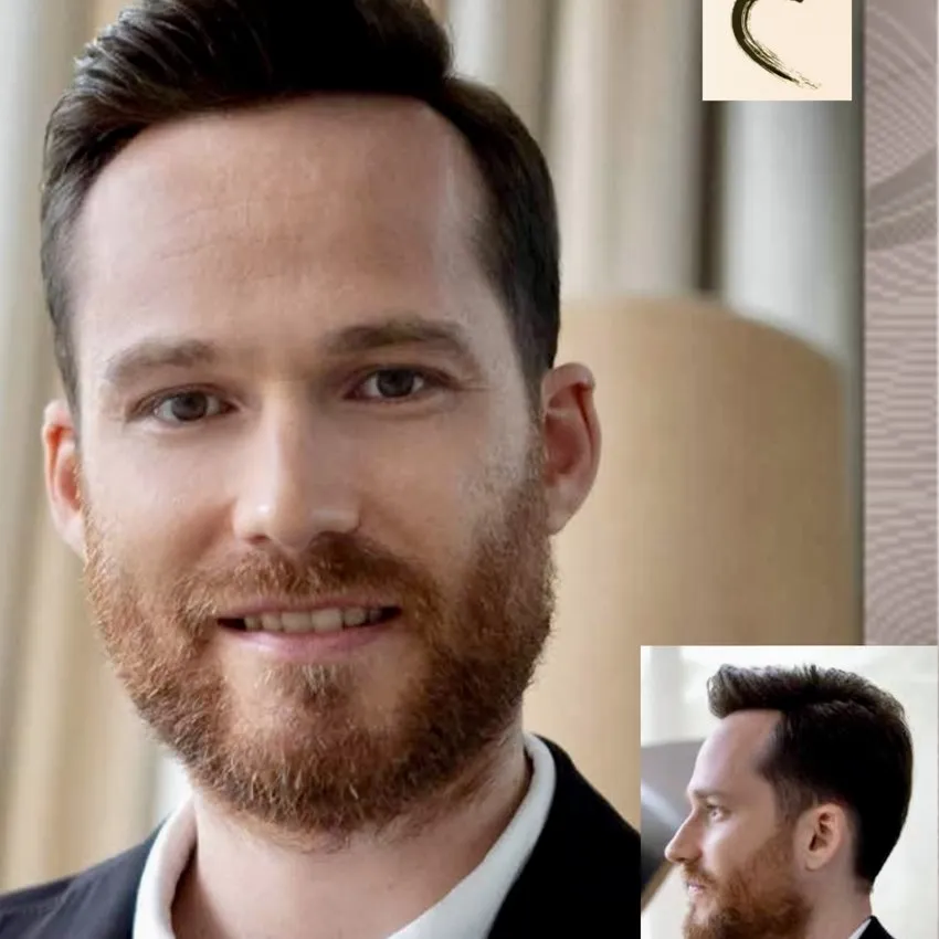 Real HEADS client — natural hairline and full hair with his hair system